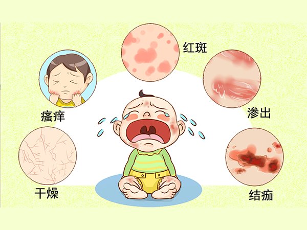 肠易激综合征